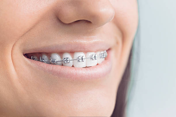 Best Full Mouth Reconstruction  in Michigan City, IN